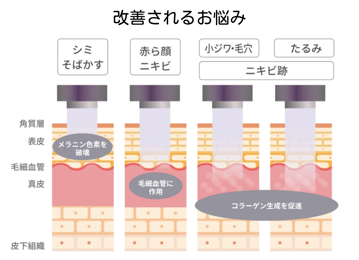 フォトフェイシャルの仕組み