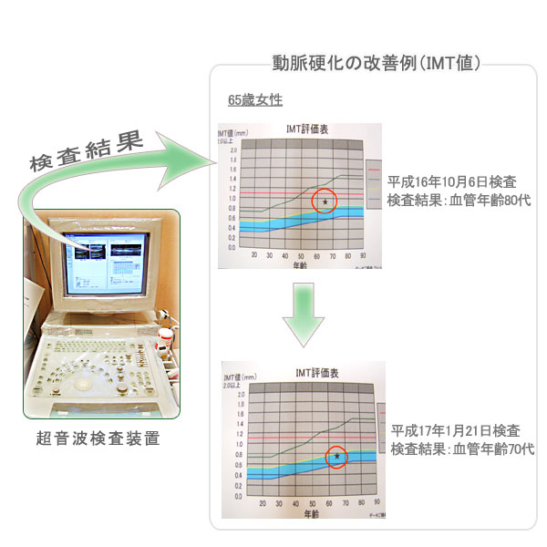 超音波検査イメージ